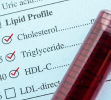 Lipid profile with cholesterol and tube of blood