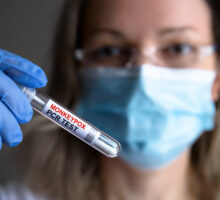 Lab worker holds a test tube with PCR test for monkeypox infections